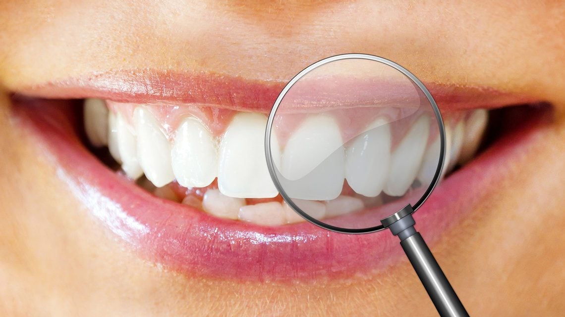 Zahnfleisch entzündet?<br>Die besten Tipps